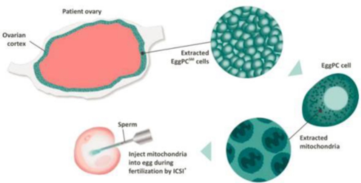 卵子干细胞基础上的第四代试管婴儿