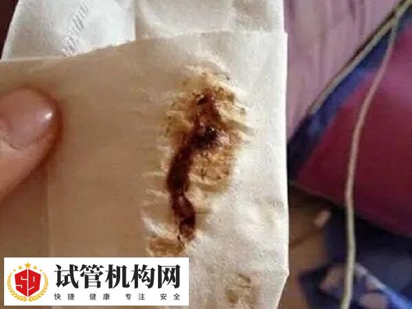 降调副作用会引起分泌物变化