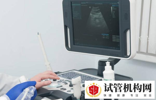 四维彩超检查什么时候出结果