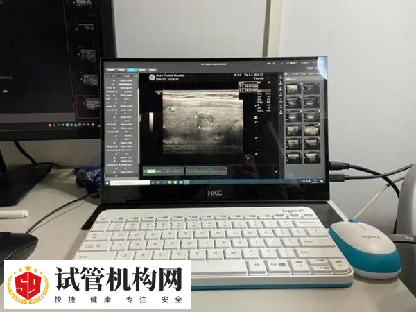 试管婴儿三胎通常不建议生下来