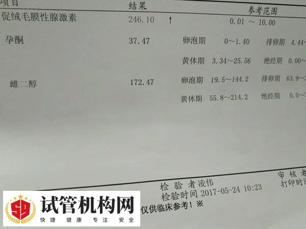 囊胚移植抽血检查的孕酮水平应大于25ng/ml