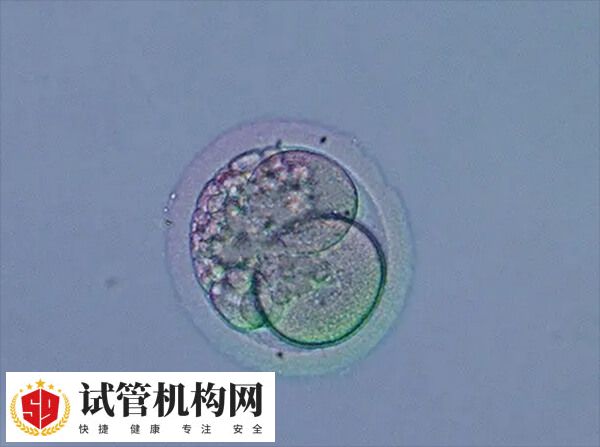 月经不规律的人适合促排卵周期方案