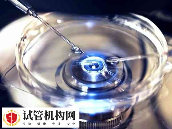 取卵是指在超声波的引导下有创地取出卵子