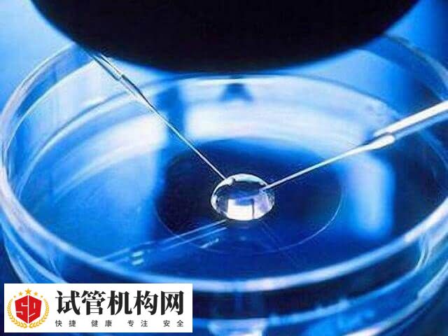 精子卵子冷冻费的缴纳方式取决于地区